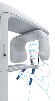 Bel-Cypher Pro Panoramic dental imaging side with figure